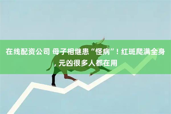 在线配资公司 母子相继患“怪病”! 红斑爬满全身, 元凶很多人都在用